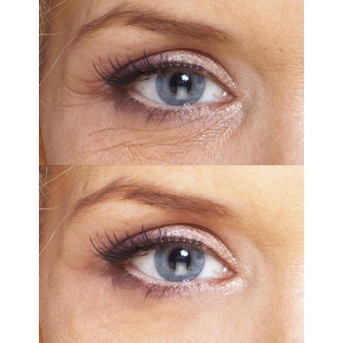 Ageless Beauty: Eye Repair Cream + Antioxidant Serum + Repair Night Hyperion