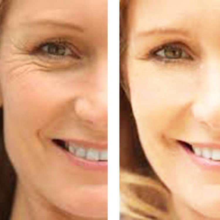 Age Defense : Eye Wrinkle Cream + Vitamin C Serum Hyperion