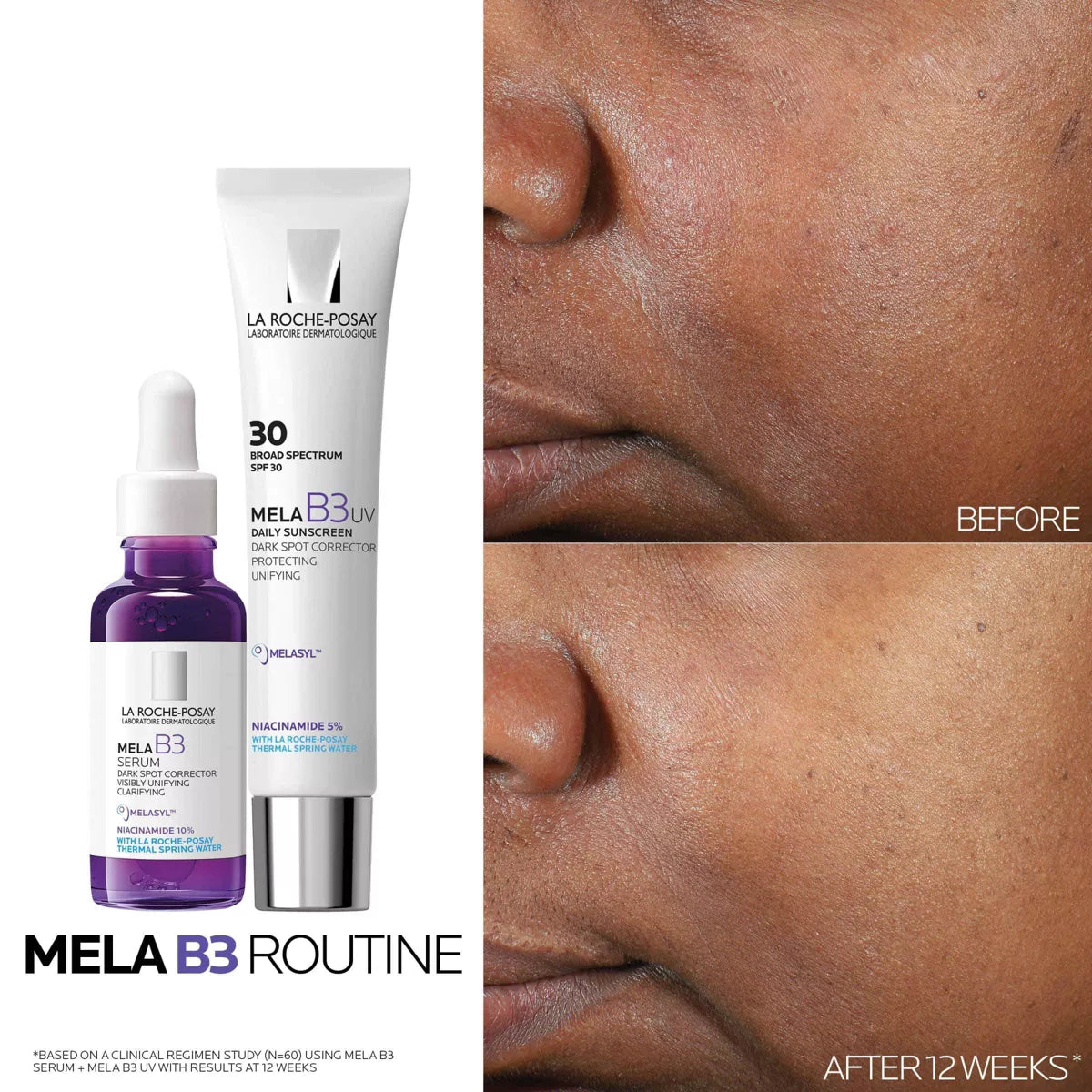 La Roche Posay Mela B3 Dark Spot Serum with Melasyl and 10% Niacinamide - 1 Fl Oz