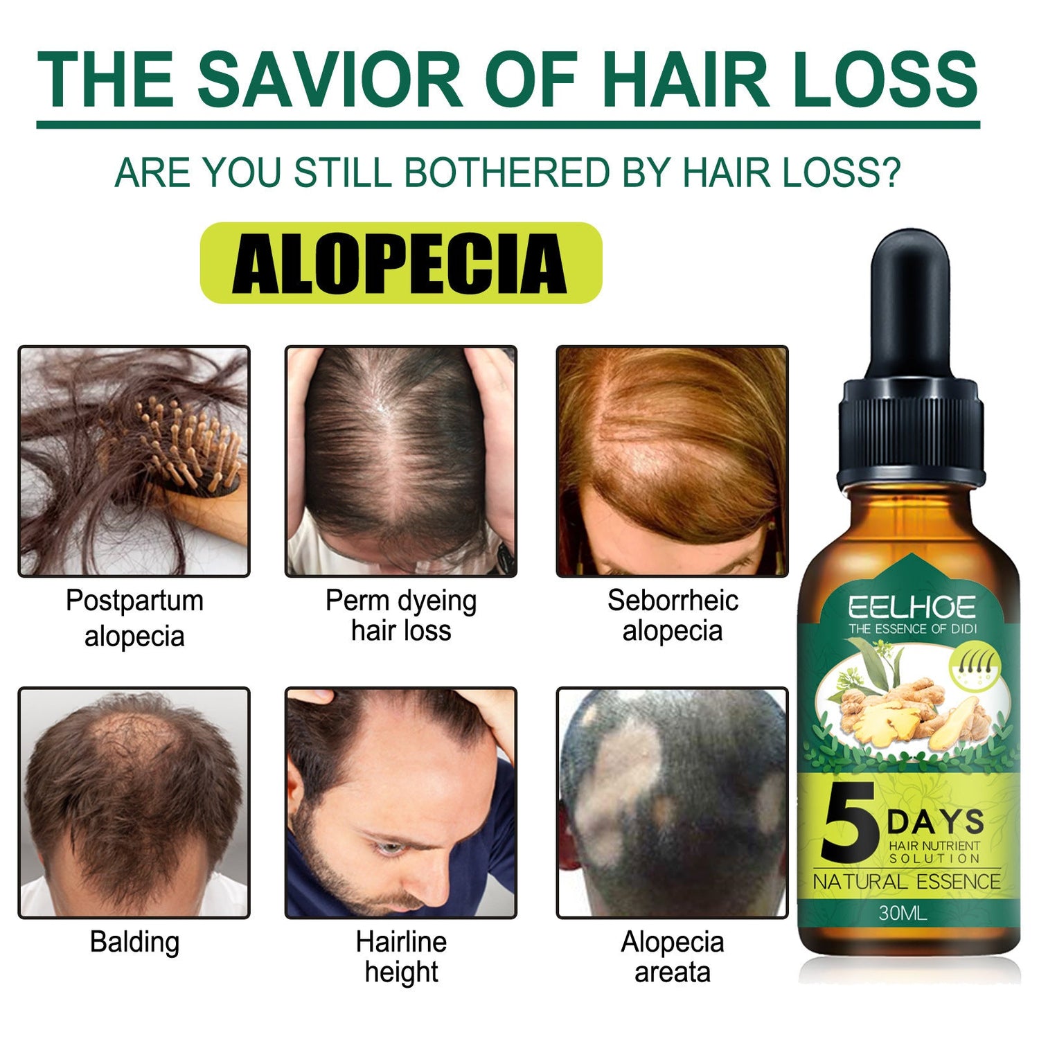 Eelhoe Ginger Hair Essential Oil. Eelhoe Ginger Hair Essential Oil CJDropshipping