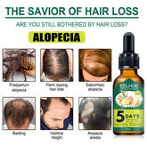 Eelhoe Ginger Hair Essential Oil. Eelhoe Ginger Hair Essential Oil CJDropshipping
