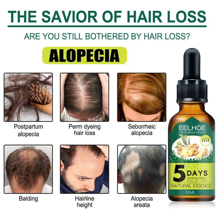 Eelhoe Ginger Hair Essential Oil. Eelhoe Ginger Hair Essential Oil CJDropshipping
