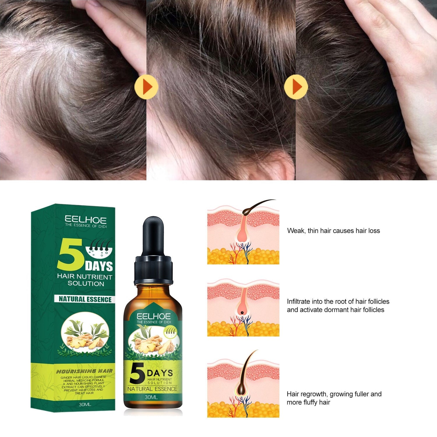 Eelhoe Ginger Hair Essential Oil. Eelhoe Ginger Hair Essential Oil CJDropshipping
