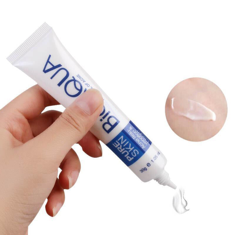BIOAQUA Face Skin Care Acne Treatment Removal Cream Spots Scar Blemish Marks