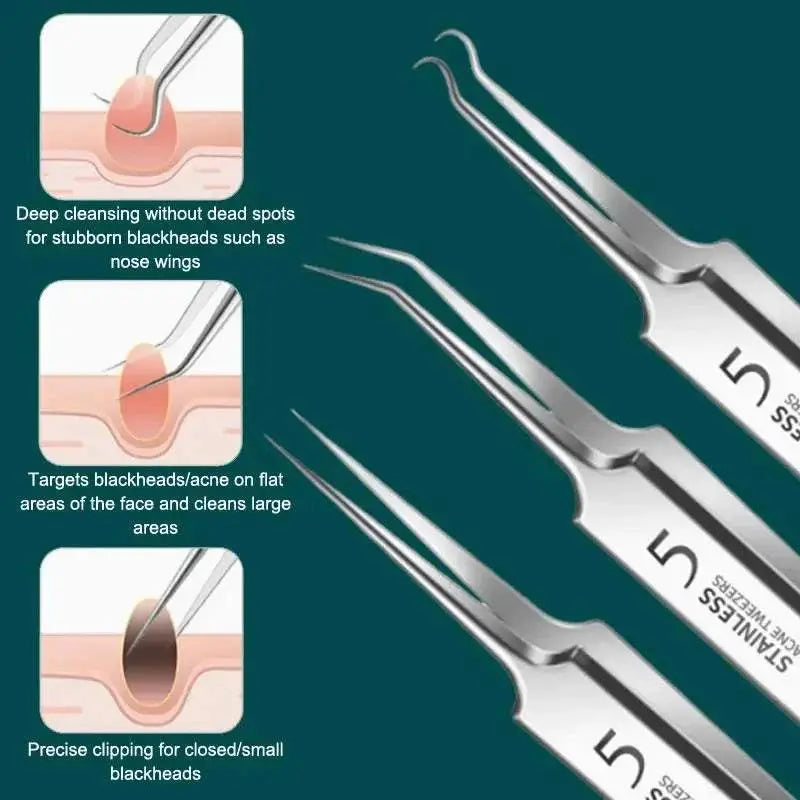 7/8Pcs Blackhead Remover Kit Professional Blackhead  Needle Skin Care Tools Stainless Steel Pimple Extraction Tools Khamik Shop Online