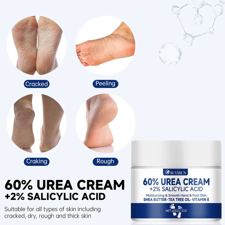 SUYARUN 60% Urea Foot Cream for Cracked Heels & Dry Skin - Intensive Moisturizing Treatment, Callus Remover, Diabetic Foot Care. Khamik Shop Online