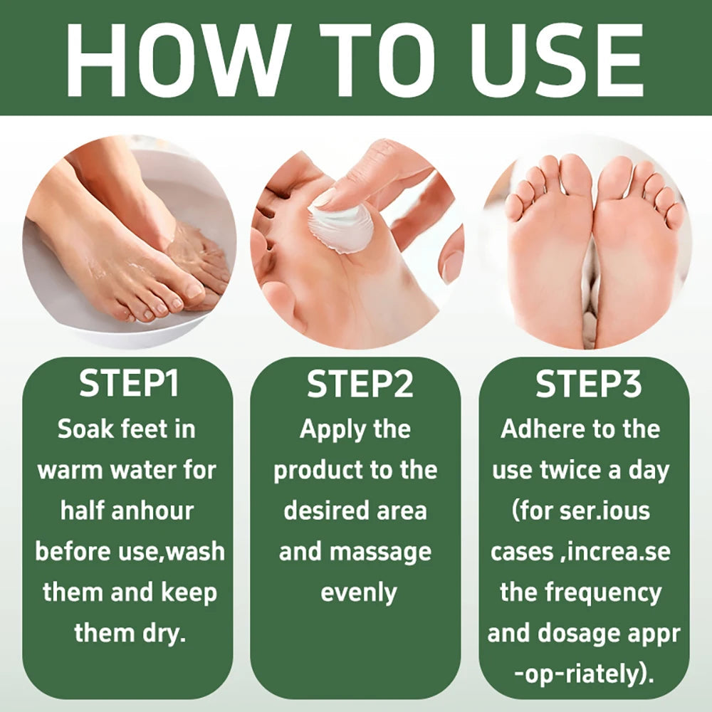 SUYARUN 60% Urea Foot Care Cream, suit for cracked heels and dry skin - deep moisturizing treatment, exfoliation, no blind spots Khamik Shop Online