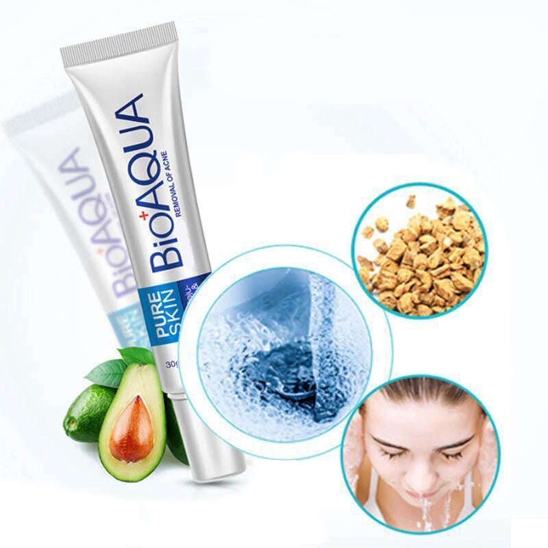 BIOAQUA Face Skin Care Acne Treatment Removal Cream Spots Scar Blemish Marks