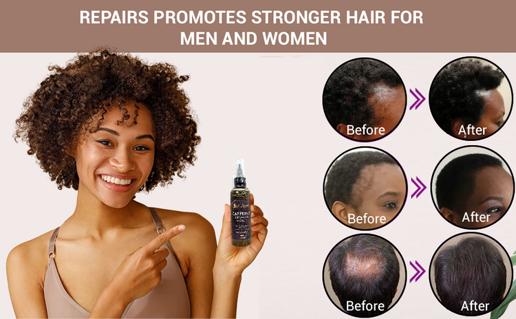 Caffeine Hair Growth Oil 2oz - Hair Growth Oil For Thinning, Balding Taupe Snowdrop