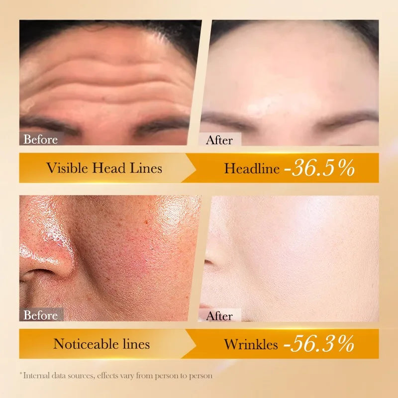 Retinol Peptide Skin Care Set Deeply nourishes and repairs Reduces wrinkles and fine lines Lightens dark circles pigmentation Khamik Shop Online