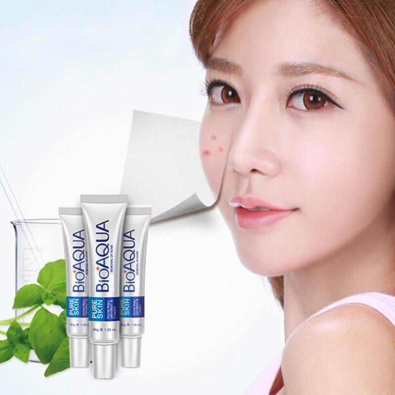 BIOAQUA Face Skin Care Acne Treatment Removal Cream Spots Scar Blemish Marks