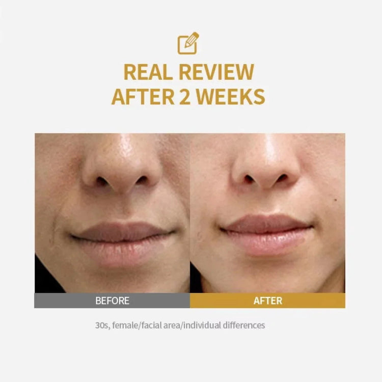 Peptide Intensive Lifting Ampoule,Deep Collagen Face Firming AliExpress
