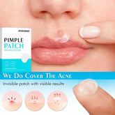 144/360/720pcs Hydrocolloid Acne Pimple Patches for Face, Effective Blemish Spot Treatment, Invisible & Skin-Friendly Khamik Shop Online