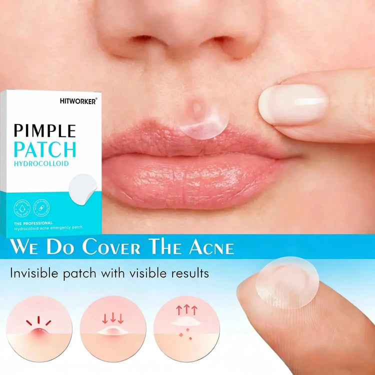144/360/720pcs Hydrocolloid Acne Pimple Patches for Face, Effective Blemish Spot Treatment, Invisible & Skin-Friendly Khamik Shop Online