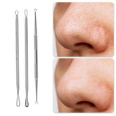 Professional Pimple Extractor Tool Kit Acne Removal Comedone Blackhead Remover Skin Care Beauty Face Tools Silver Tone Khamik Shop Online