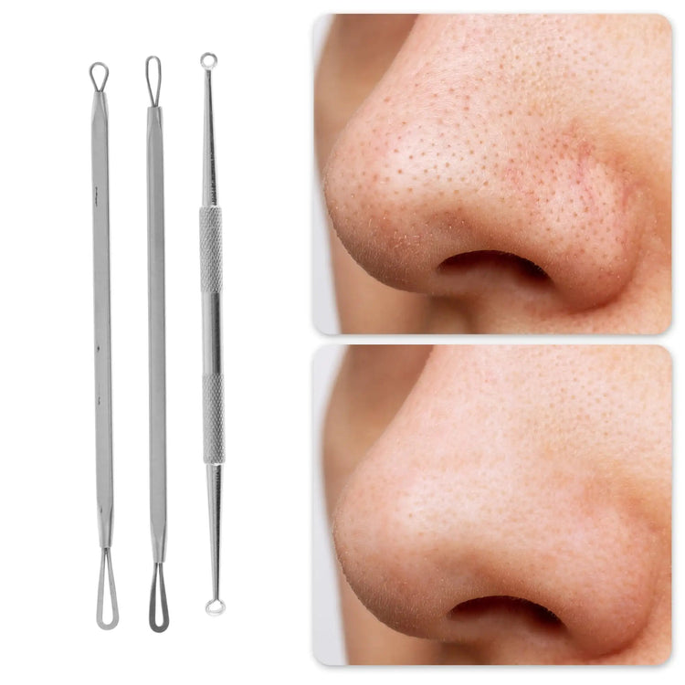Professional Pimple Extractor Tool Kit Acne Removal Comedone Blackhead Remover Skin Care Beauty Face Tools Silver Tone Khamik Shop Online