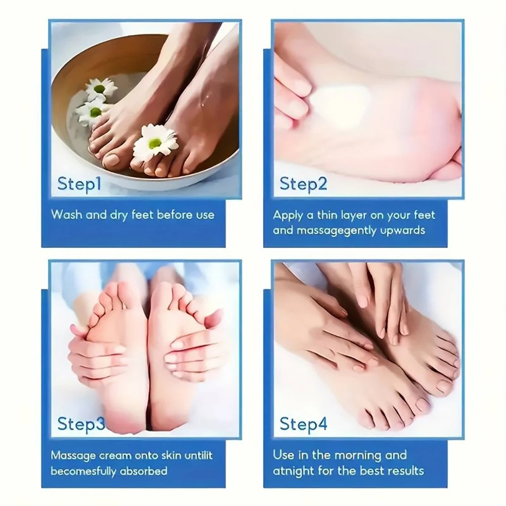 SUYARUN 60% Urea Foot Cream for Cracked Heels & Dry Skin - Intensive Moisturizing Treatment, Callus Remover, Diabetic Foot Care. Khamik Shop Online