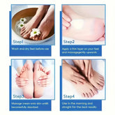 SUYARUN 60% Urea Foot Cream for Cracked Heels & Dry Skin - Intensive Moisturizing Treatment, Callus Remover, Diabetic Foot Care. Khamik Shop Online