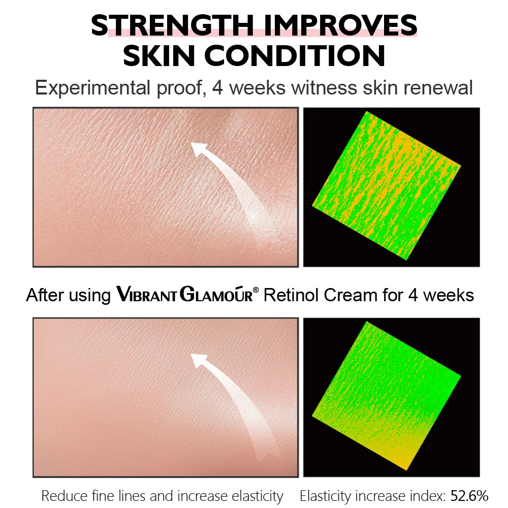 Retinol Facial Cream Anti-aging Removal Wrinkle Fine Lines Repair Skin Barrier Whitening Brightening Moisturizing Face Cream Khamik Shop Online