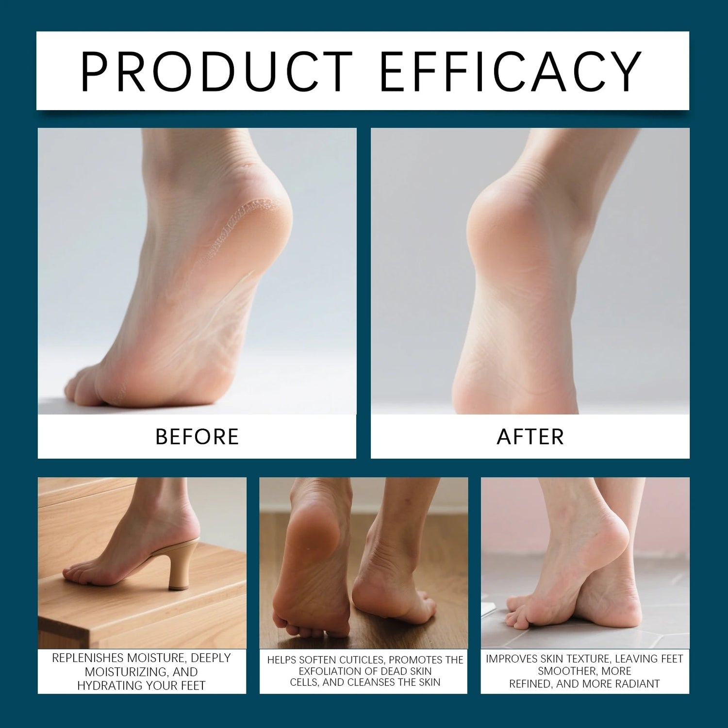 OCEAURA 100ml Foot Cuticles Remover Solution No Tools Required Gentle Non-irritating Removes Foot Cuticles Callus Restore Smooth Khamik Shop Online