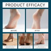 OCEAURA 100ml Foot Cuticles Remover Solution No Tools Required Gentle Non-irritating Removes Foot Cuticles Callus Restore Smooth Khamik Shop Online