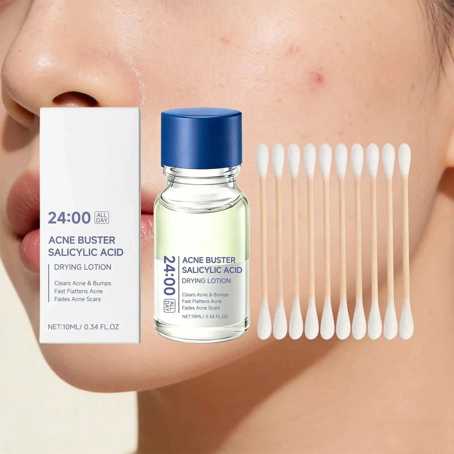 Salicylic Acid Drying Lotion Face Serum with Cotton Swab– Reduce Pimples & Breakouts Fade Acne Scars Minimize Pores Skin Renewal Khamik Shop Online