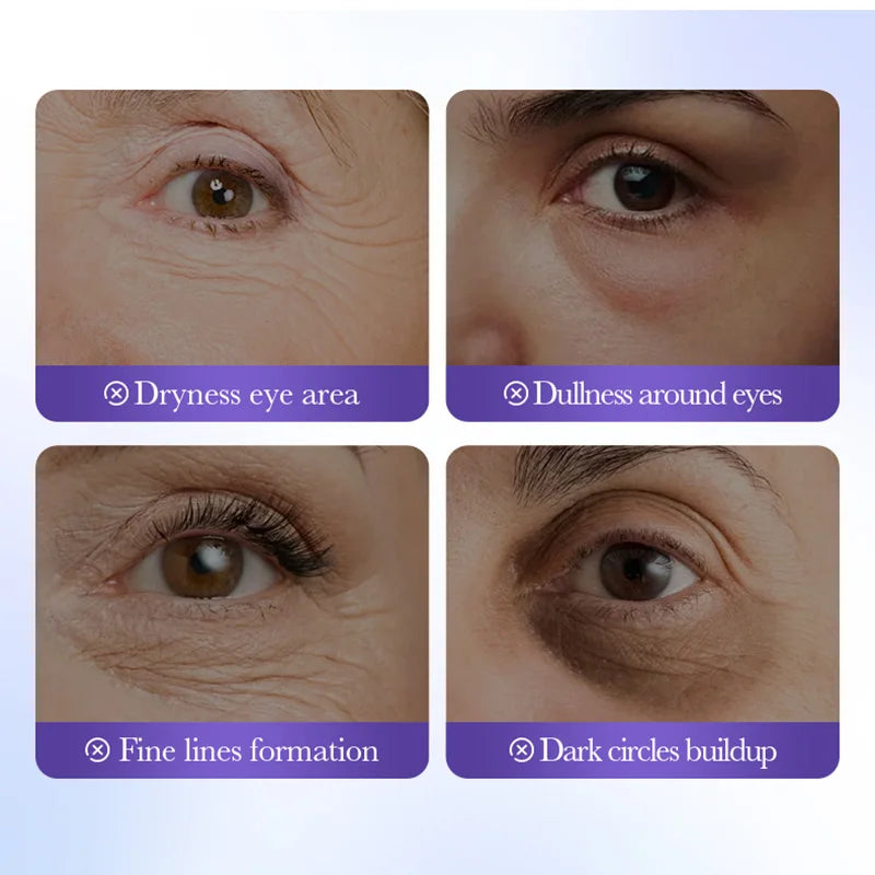 80Pcs BIOAQUA Retinol Crystal Collagen Eye Mask anti Dark Circles Anti-Wrinkles Moisturizing Anti-Aging Eye Patches Skin Care